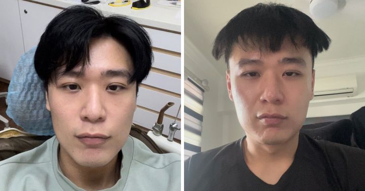 Desmond Lim, before and after. 