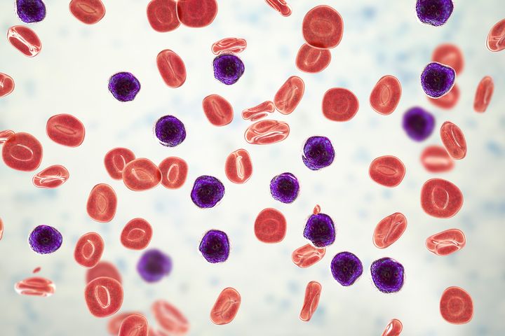 Imagen microscópica de células cancerígenas.