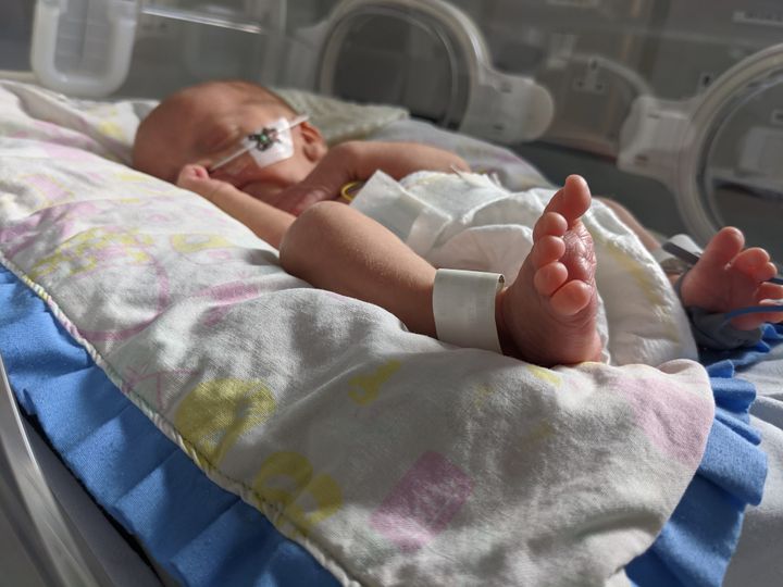 Dolly's son pictured in NICU.