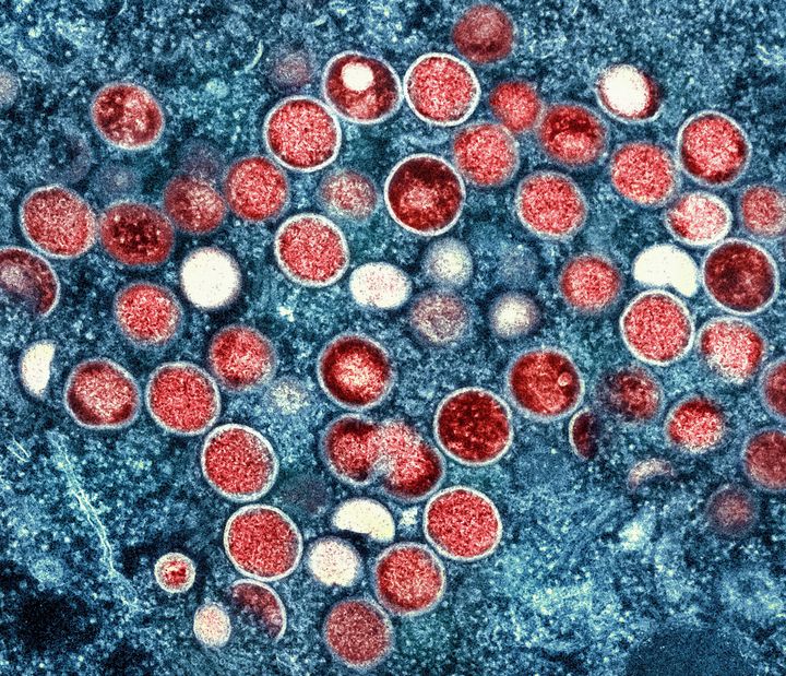 The World Health Organization has renamed monkeypox as mpox, citing concerns the original name of the decades-old animal disease could be construed as discriminatory and racist. Colorized monkeypox particles (red) are seen within an infected cell (blue) in a Maryland laboratory. 