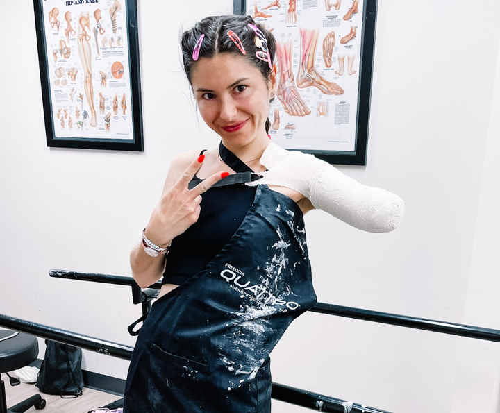 "Wearing my LBD and too many hair clips as I get cast for my first prosthesis," the author writes.