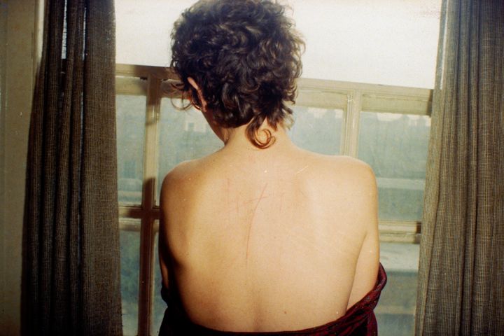 Nan Goldin's "Self portrait with scratched back after sex, London," 1978.