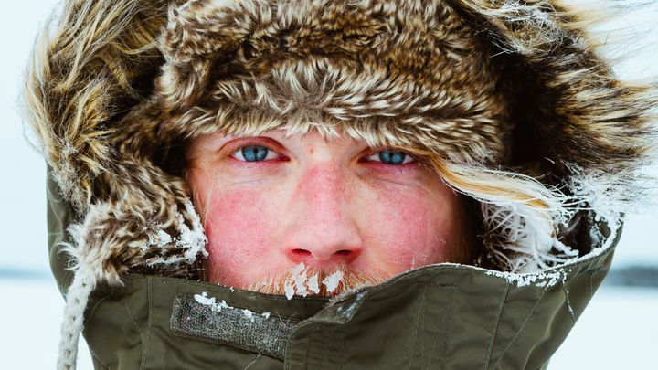 How To Prevent And Treat Windburn, An Overlooked Winter Skin
