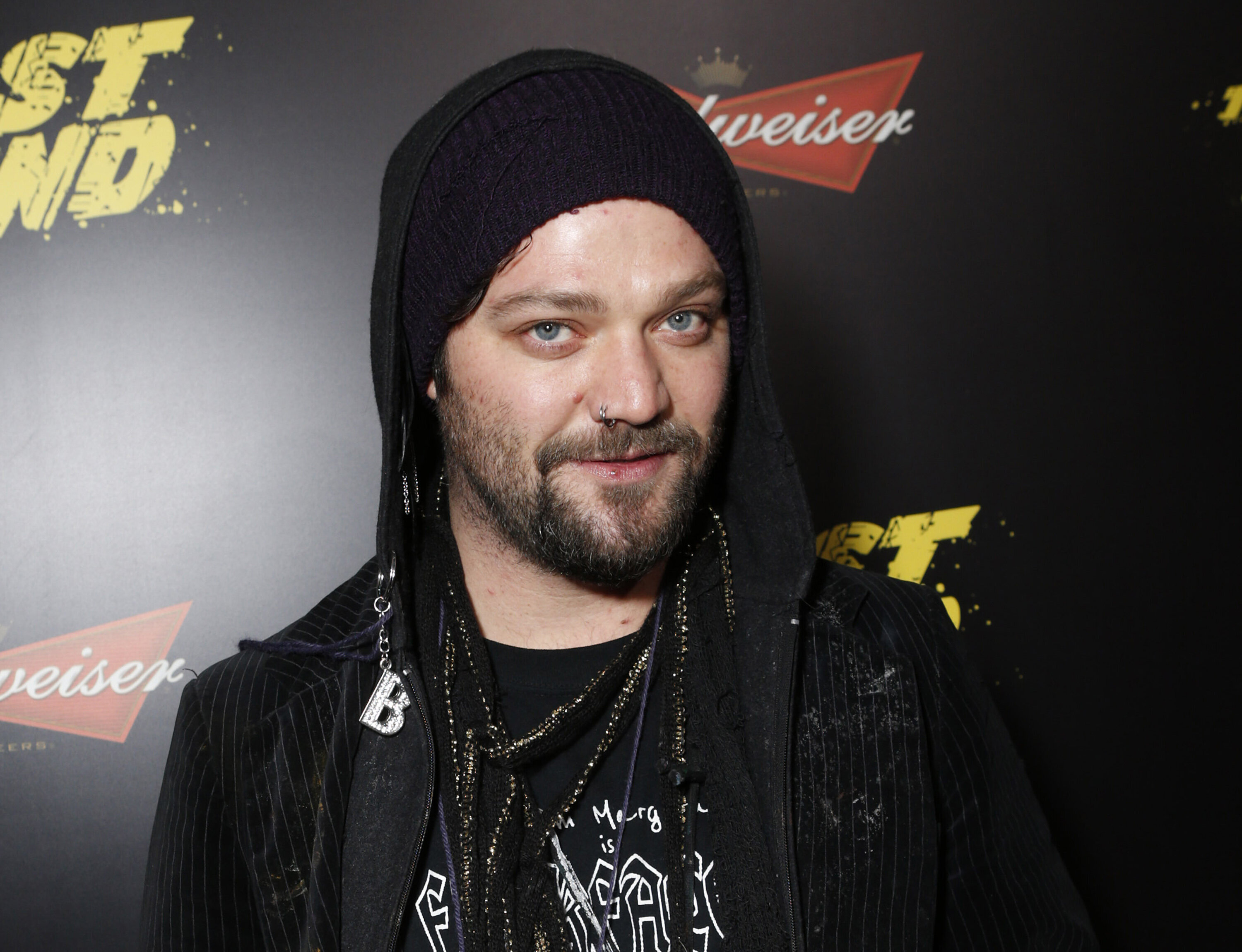 Bam Margera Admits He Was ‘Declared Dead’ Among Other Health Issues ...