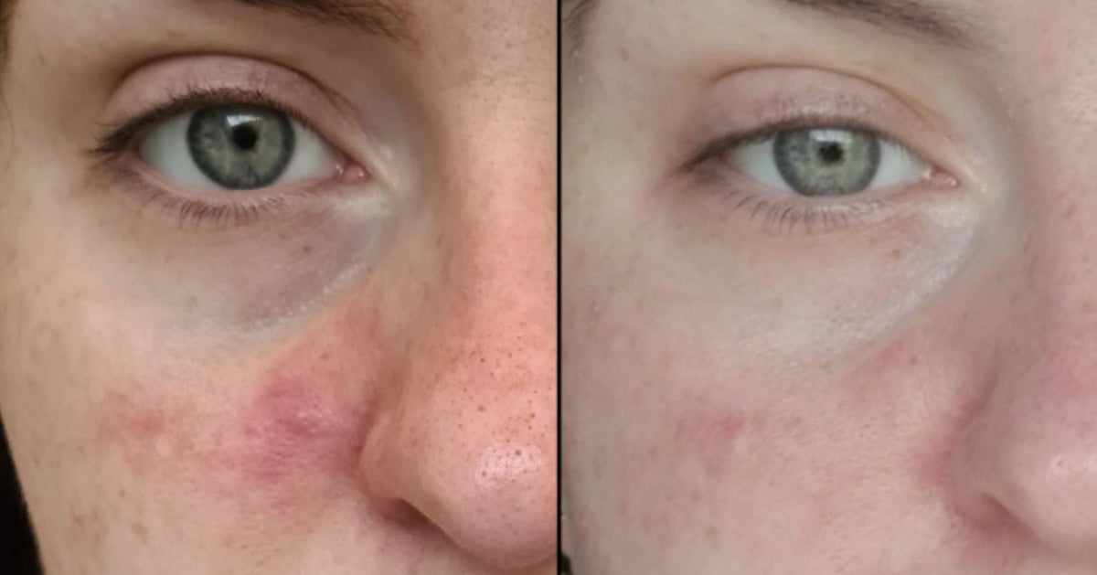 The Inkey List Skin Care Products: What Derms Think The Inkey List Skin Care Products: What Derms Think