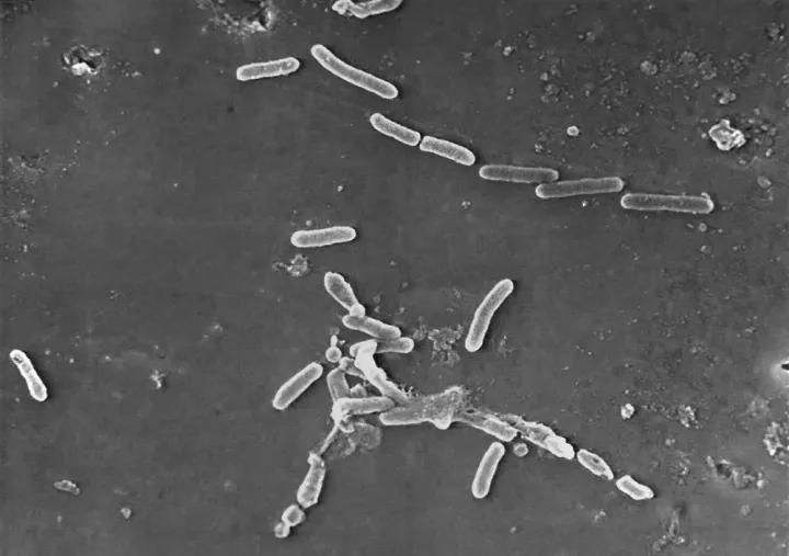 FILE - This scanning electron microscope image made available by the Centers for Disease Control and Prevention shows rod-shaped Pseudomonas aeruginosa bacteria. U.S. health officials are advising people to stop using the over-the-counter eye drops, EzriCare Artificial Tears, that have been linked to an outbreak of drug-resistant infections of Pseudomonas aeruginosa. 