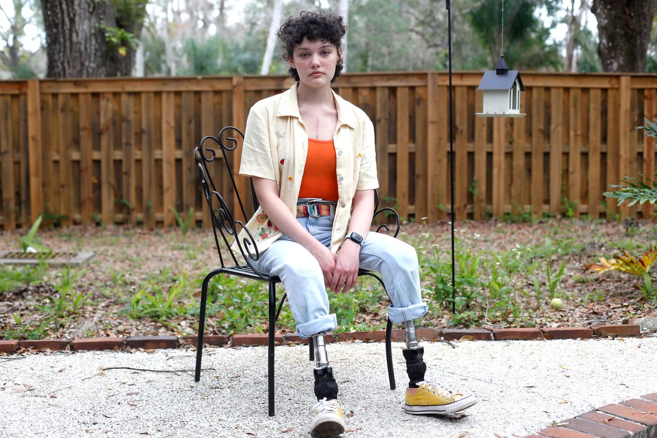 Claire Bridges of Tampa, Florida, had both legs amputated last year due to complications from COVID-19.