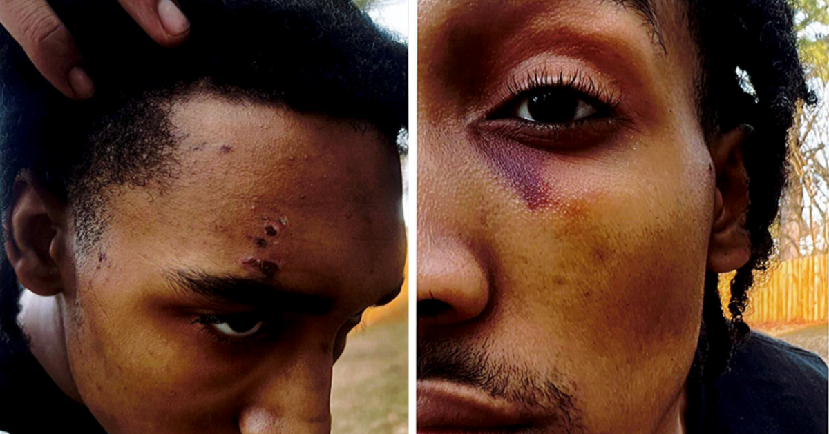NextImg:Memphis Man’s $5 Million Suit Alleges Cops In Tyre Nichols' Arrest Also Beat Him