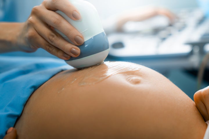 The nuchal translucency screening is performed via ultrasound.