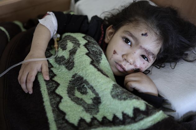 シリア・イドリブ県でがれきの中から救出され治療を受ける5歳のシャム・アル=アフマドさん（2023年2月10日）