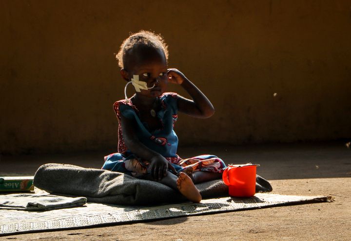 H πείνα στο Σουδάν δεν είναι κάτι καινούριο. Η μόλις δύο ετών Ακόν Μόρρο πάσχισε να κρατηθεί στη ζωή λόγω προβλημάτων υγείας από τον υποσιτισμό ήδη το 2020. Εν μέσω πανδημίας όμως και πολέμου, που εκτόξευσε τις τιμές των σιτηρών και ενώ οι προϋπολογισμοί ΜΚΟ μειώθηκαν και η διεθνής βοήθεια σταμάτησε, ο θάνατος για εκατομμύρια παιδιά έρχεται όλο και πιο κοντά. 