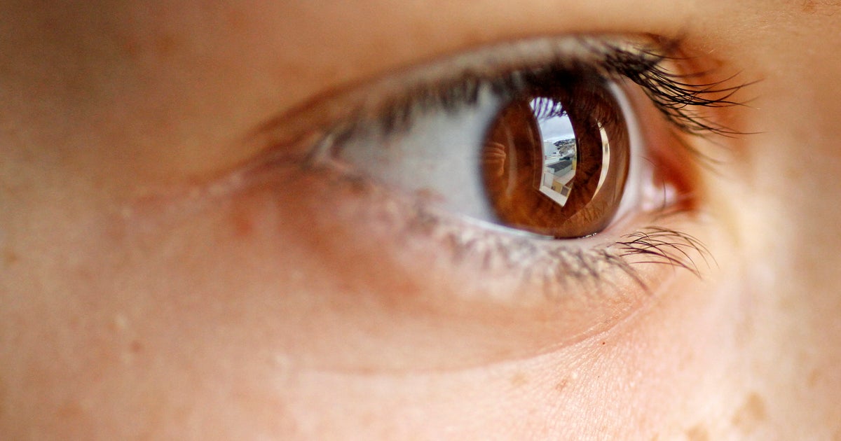 Yes, Lack Of Sleep Can Affect Your Vision - Vimarsana News
