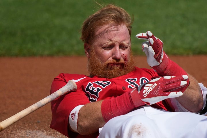 Boston Red Sox Justin Turner reacts after being hit in the face on a pitch by Detroit Tigers starting pitcher Matt Manning in the first inning of their spring training baseball game in Fort Myers, Fla., Monday, March 6, 2023. (AP Photo/Gerald Herbert)