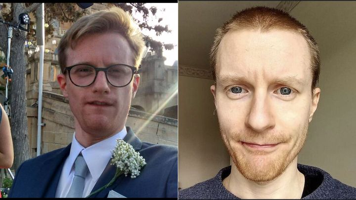Owen White, pictured here before and after having COVID, said long COVID feels like fighting a "double hangover."