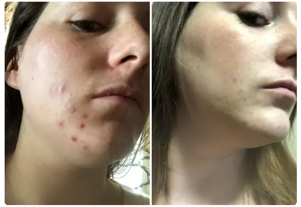 30 Products Reviewers In Their 30s Swear By 22 641099b92500003b009e2651