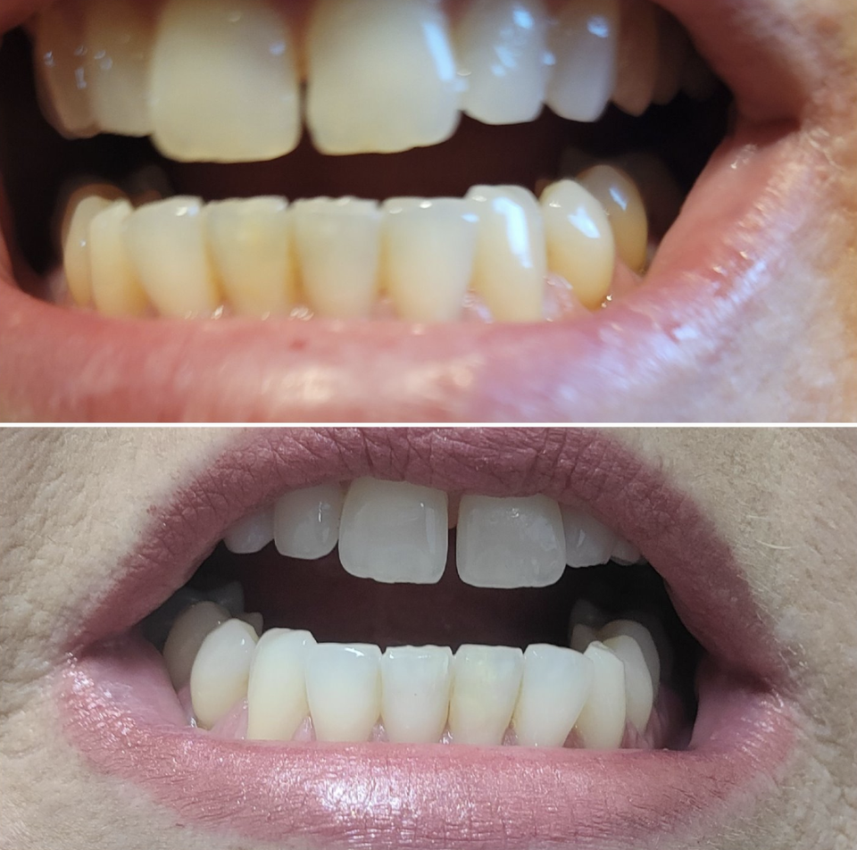 Here Are 49 Products Reviewers Are Obsessed With 14 6413cff61f0000590099a12b