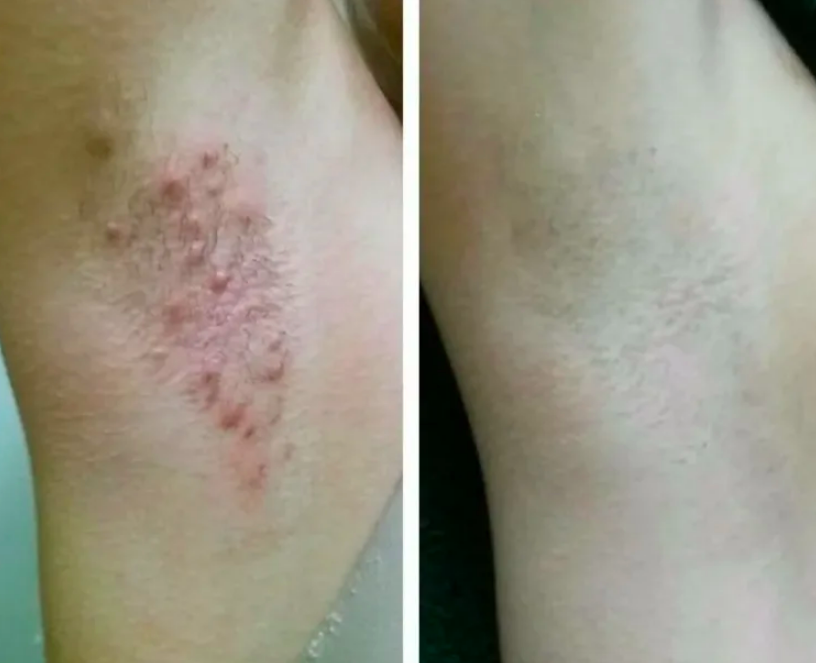 Here Are 49 Products Reviewers Are Obsessed With 28 6413cffc2200005900eae352