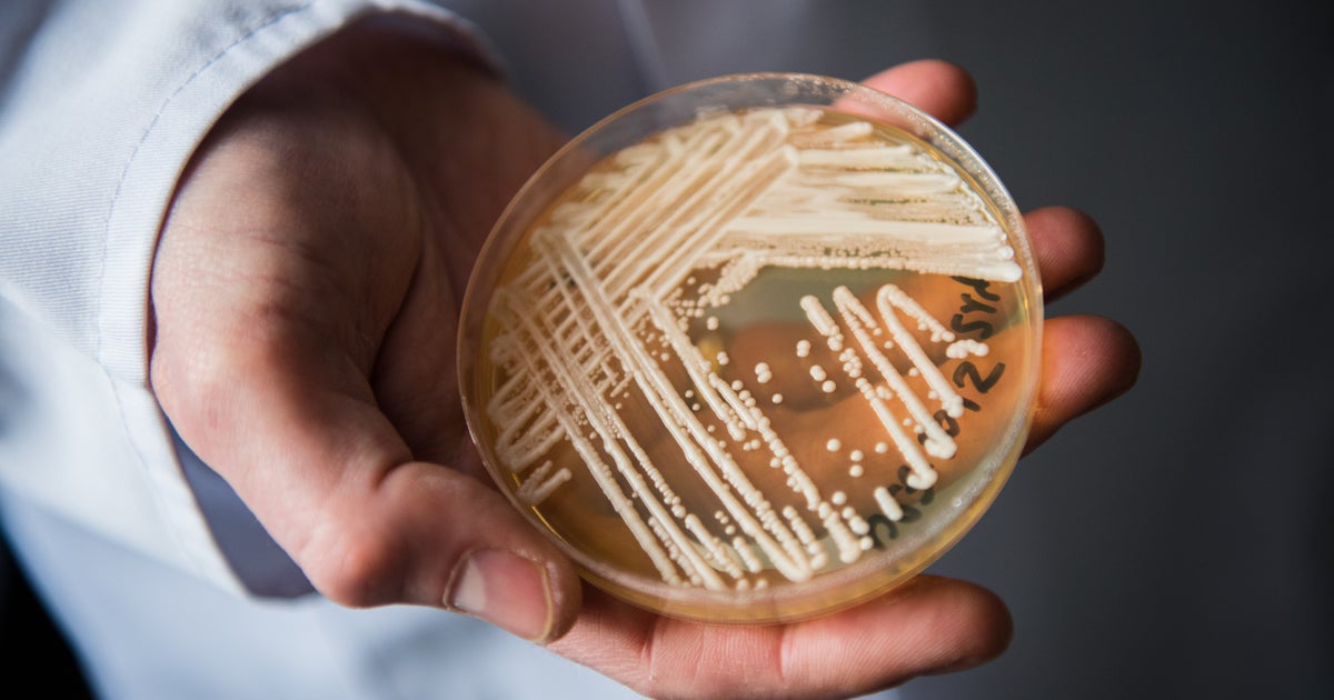 NextImg:Deadly Drug-Resistant Fungus Spreading In U.S. At 'Alarming Rate': CDC