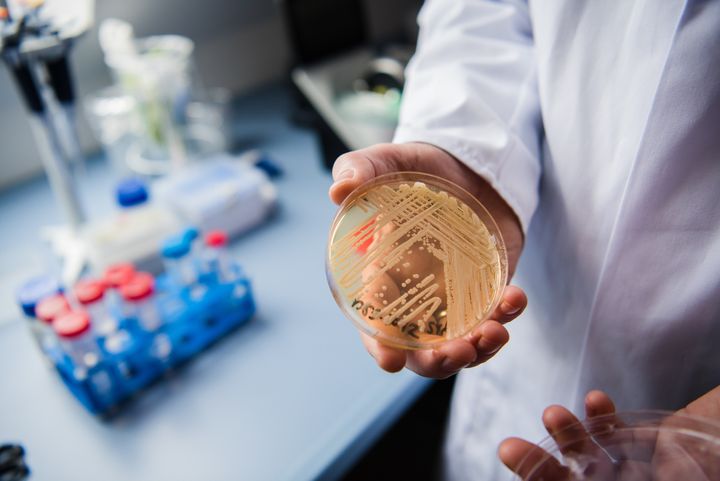 The director of the National Reference Centre for Invasive Fungus Infections, Oliver Kurzai, holding in his hands a petri dish that has the yeast Candida auris in a Wuerzburg University laboratory in Wuerzburg, Germany on Jan. 23, 2018. There has been a recent rise of cases of seriously ill patients becoming infected with C. auris.