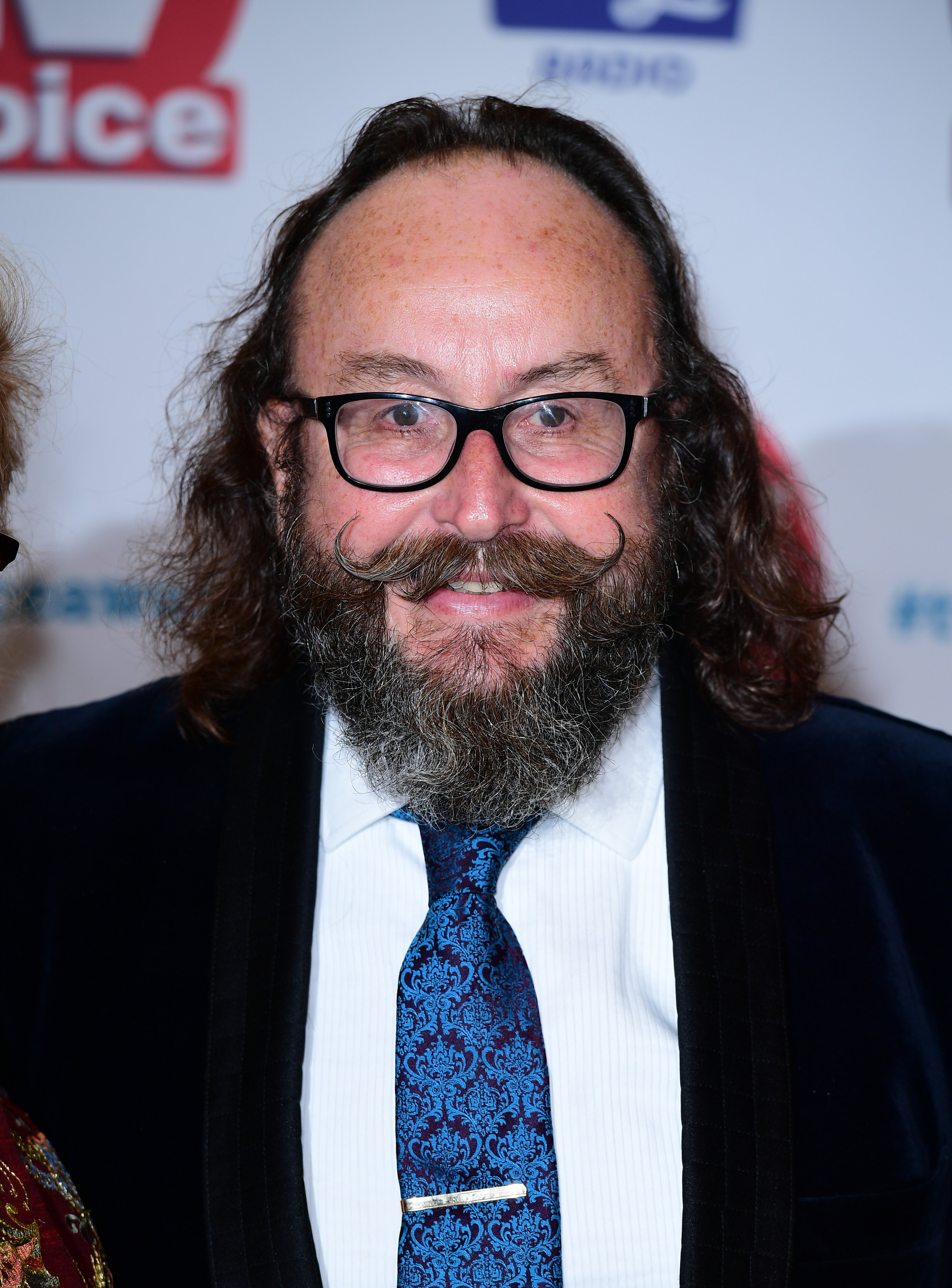 Hairy Bikers Star Dave Myers Opens Up About Brutal Side Effects Of Chemotherapy