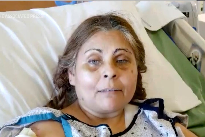 Patricia Borges was pulled live from the rubble of the R.M. Palmer Co. mill aft an detonation that killed 7 co-workers.