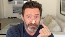 Hugh Jackman Reveals Skin Cancer Biopsies With Nose-Bandaged Sunscreen PSA