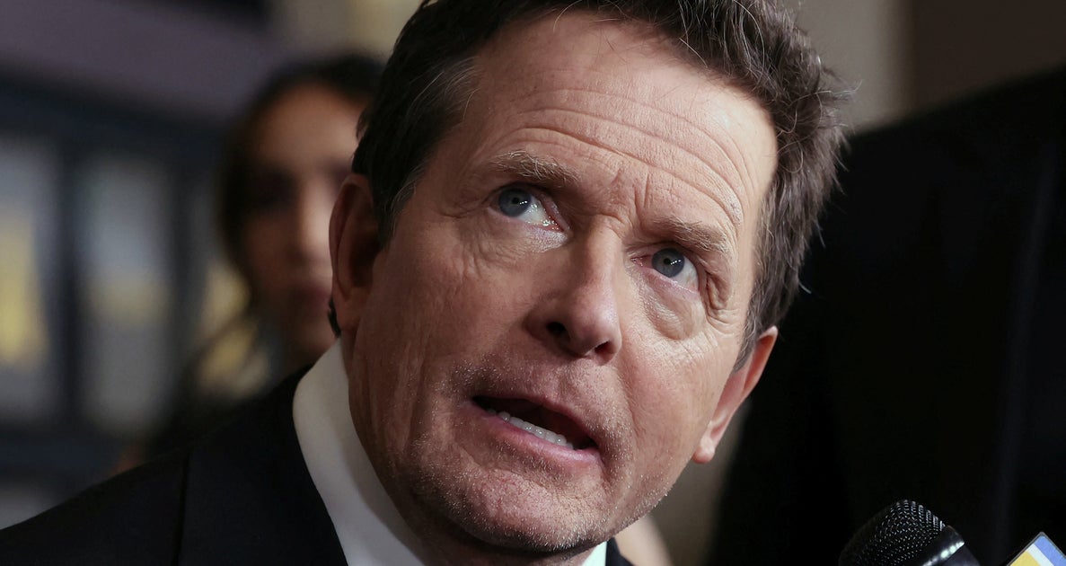 Michael J. Fox Reflects On Life Expectancy With Parkinson’s: ‘I’m Not Gonna Be 80’