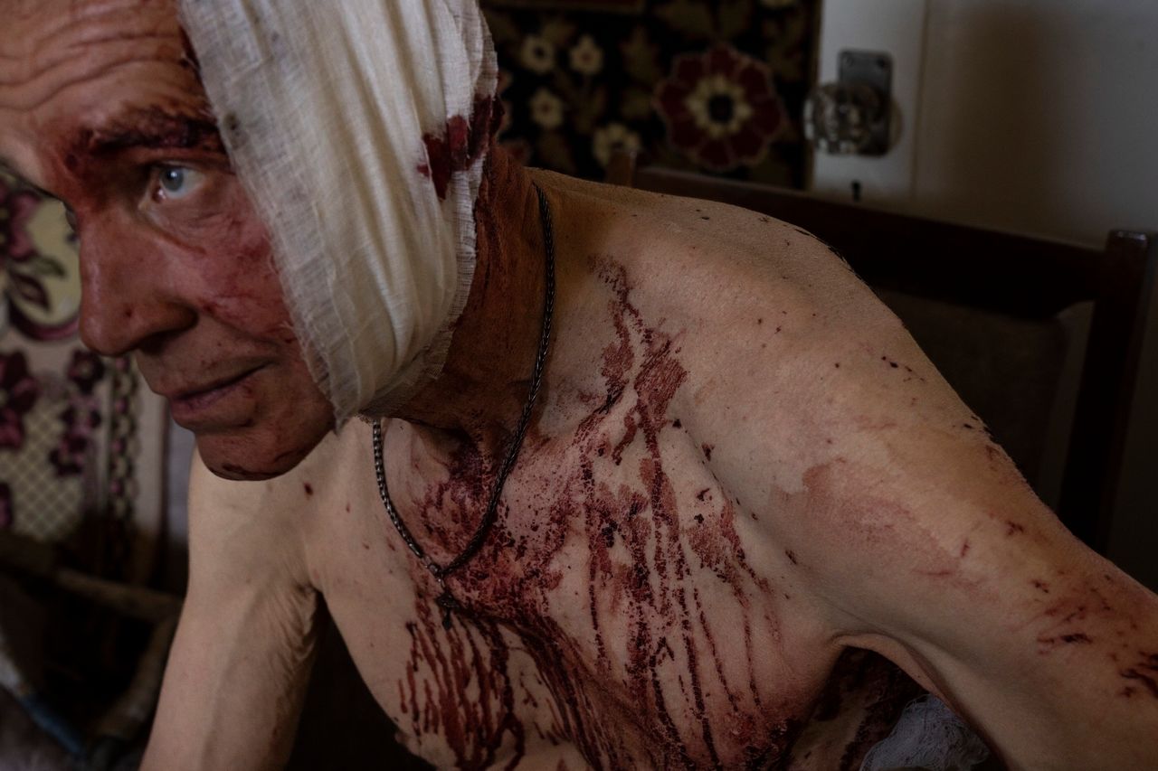 Ο Volodymyr, τραυματισμένος από απεργία, κάθεται στο κατεστραμμένο διαμέρισμά του στο Kramatorsk, στην περιοχή Donetsk, στην ανατολική Ουκρανία, 7 Ιουλίου 2022. Η εικόνα ήταν μέρος μιας σειράς εικόνων από φωτογράφους του Associated Press που τιμήθηκε με το βραβείο Pulitzer 2023 για τη φωτογραφία έκτακτων ειδήσεων. (AP Photo/Nariman El-Mofty)
