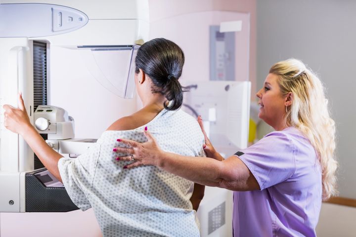 This week, the U.S. Preventive Services Task Force updated its mammogram guidelines, which now align with the recommendations from many other organizations. 