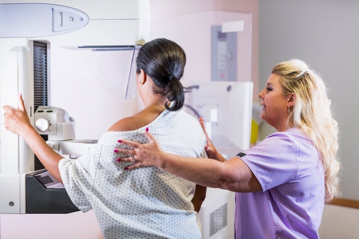 This week, the U.S. Preventive Services Task Force updated its mammogram guidelines, which now align with the recommendations from many other organizations.