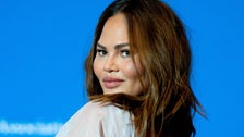 Chrissy Teigen Debunks Surrogacy Conspiracy With C-Section Snap