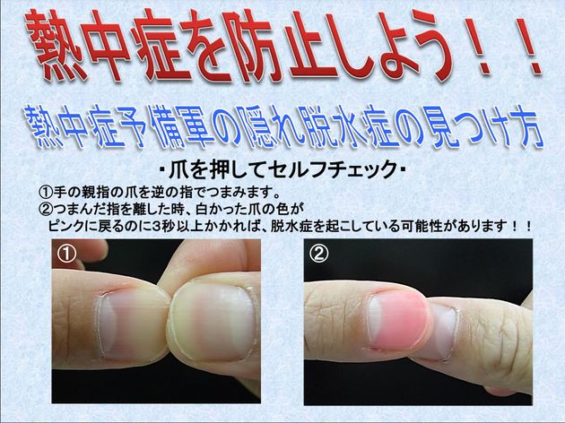 爪を押してセルフチェックする方法