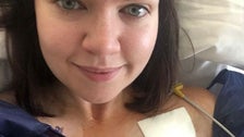 Most People Don’t Need Pacemakers Until Retirement Age. I Had To Get One At 26.