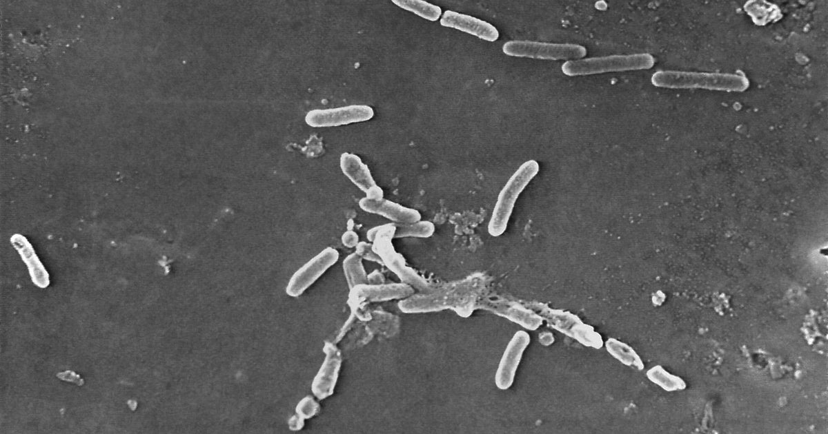 Fourth Death Linked To Recalled Eye Drops, CDC Says Fourth Death Linked To Recalled Eye Drops, CDC Says