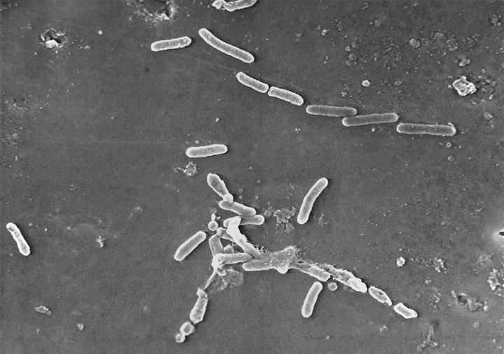 This scanning electron microscope image made available by the Centers for Disease Control and Prevention shows rod-shaped Pseudomonas aeruginosa bacteria. Four deaths and additional cases of vision loss have been linked to eyedrops from EzriCare and Delsam Pharma that were tainted with the drug-resistant bacteria. 