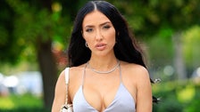 ‘Selling Sunset’ Star Says She’s Like A ‘Guinea Pig’ While Sharing Plastic Surgery History