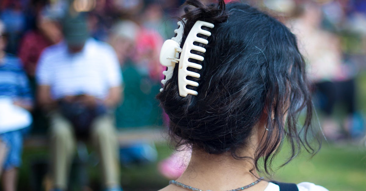 Yup A Claw Clip Really Did Get Stuck In A Woman's Head In A Car Crash