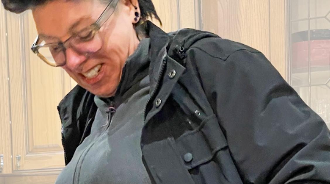 I Lost 85 Pounds. Then I Had My Loose Skin Removed... And Did Something With It That Shocks People