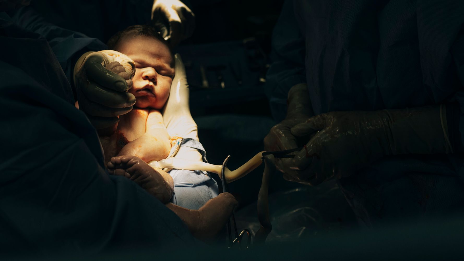 C-Section what you need to know? 