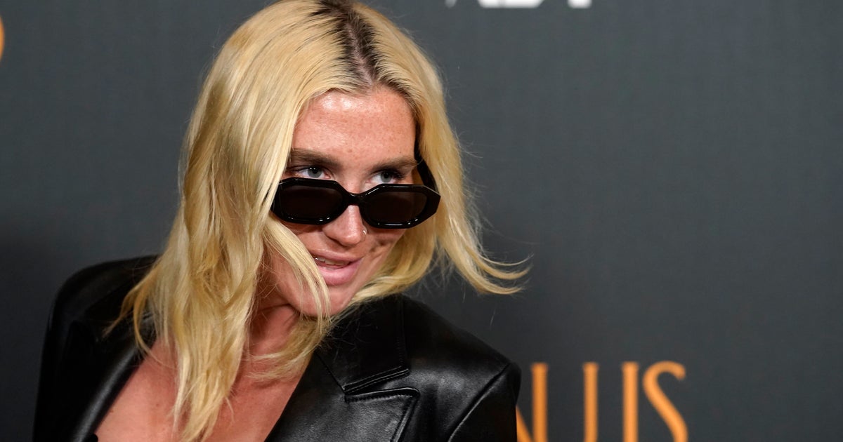 Kesha And Dr. Luke Settle Defamation Lawsuit 8 Years After Rape Accusation