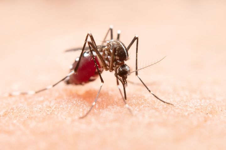Five cases of locally transmitted malaria were recently confirmed in the U.S., which generally eliminated the disease in the 1950s.