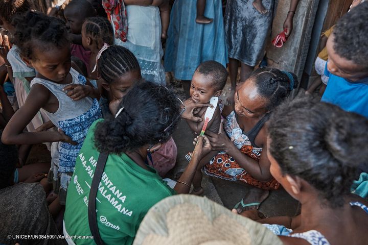 アツィモ・アンドレファナ県の遠隔地にある村を訪れたユニセフが支援する移動式栄養クリニックで、上腕計測メジャーを使った栄養検査を受け、重度の栄養不良と診断された2歳のミチンジュちゃん。(マダガスカル、2023年3月撮影)