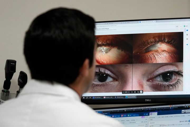 Ο Δρ Σάμπατερ δείχνει φωτογραφίες του Αντόνιο Βέντο Καρβαγιάλ πριν και μετά τη χειρουργική επέμβαση και την γονιδιακή θεραπέια σταγόνων. 