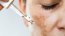 'Free Radicals' Can Majorly Damage Your Skin. Here's What You Should Know About Them.