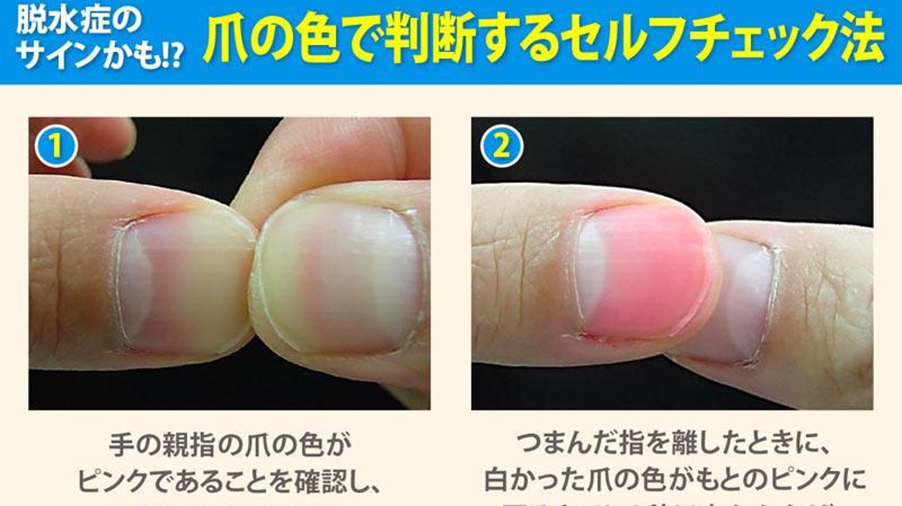脱水 症状 チェック