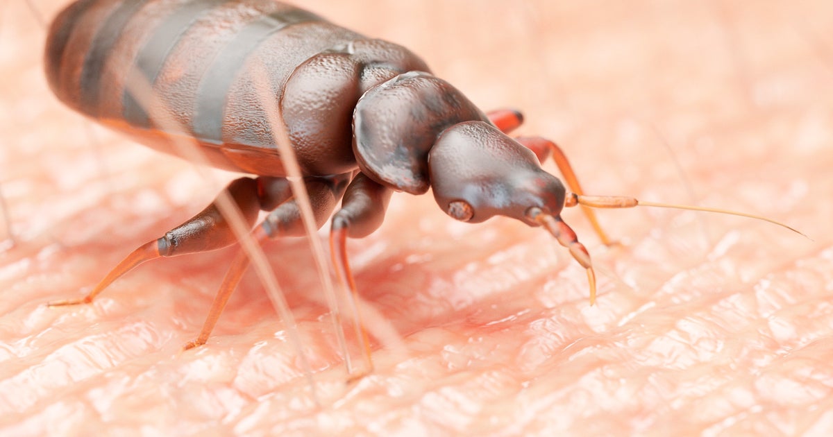 We’re In A Bed Bugs Epidemic, Here’s How To Banish Them For Good