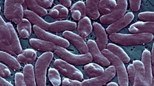 Rare Flesh-Eating Bacteria Infections Kill 3 In Connecticut, New York