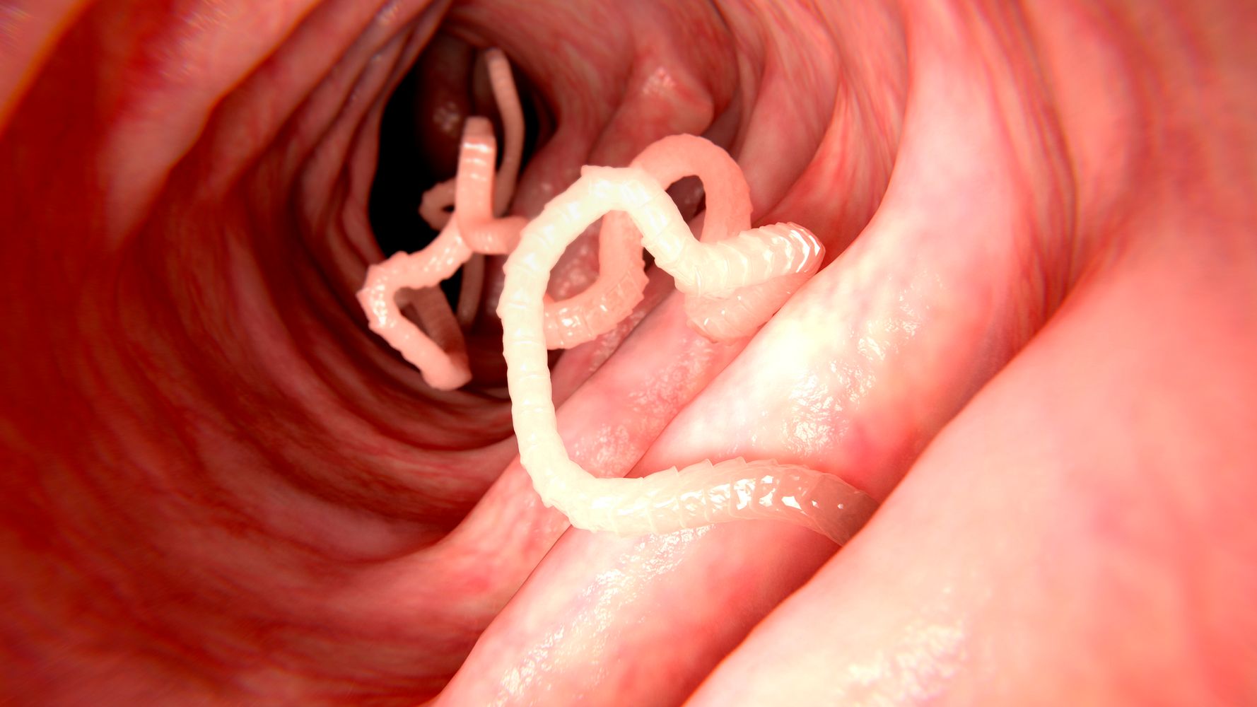Doctors found a snake parasite in a woman's brain — still alive