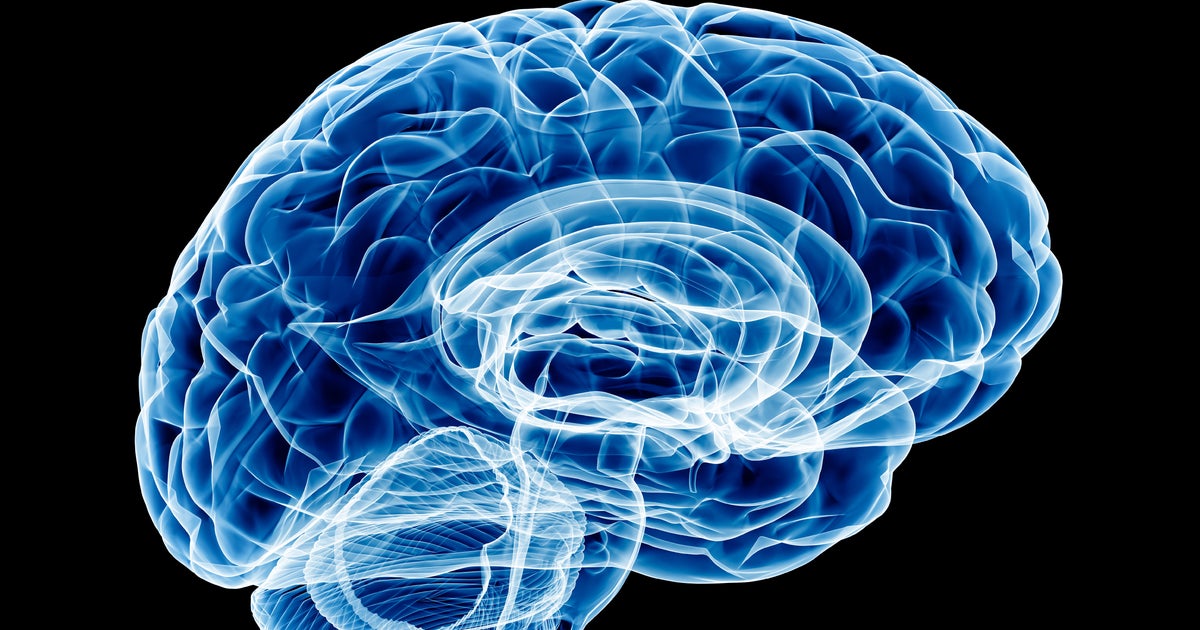 Yes, You're Forgetting Something — But Don't Be So Quick To Blame 'Mommy Brain'