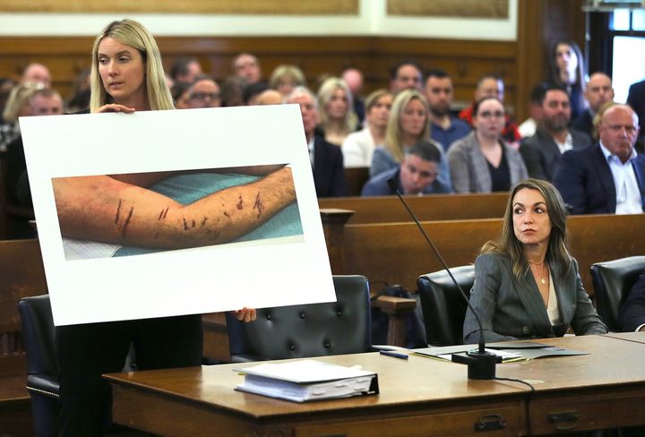 The defense team for Karen Read, seated on the right, holds up an autopsy photo of injuries sustained on John O'Keefe's arm in Norfolk County Superior Court.